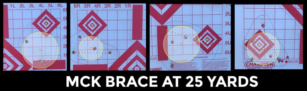 MCK brace results